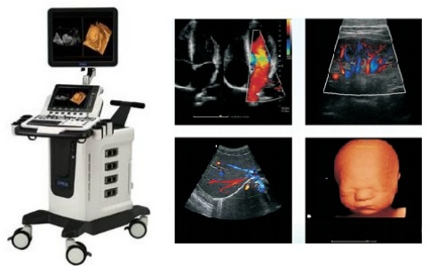 时迈全数字彩色多普勒超声诊断系统S70
